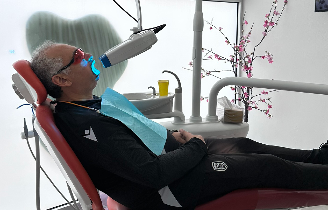 A man reclined in a dental chair, mouth open, in the middle of a teeth whitening treatment.